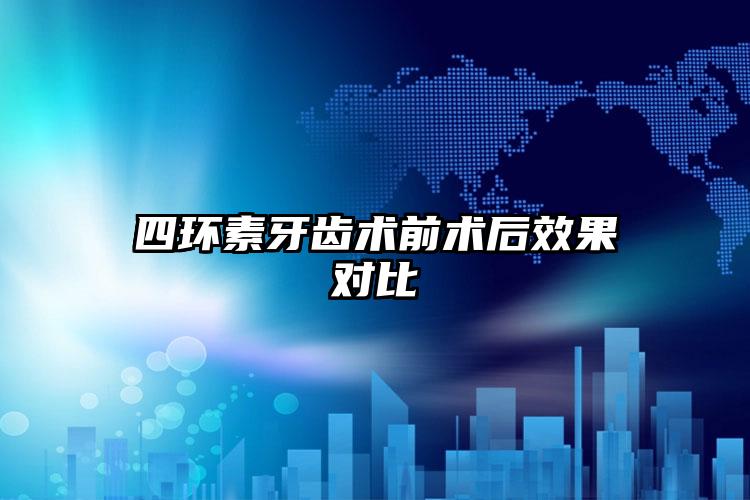 四环素牙齿术前术后效果对比