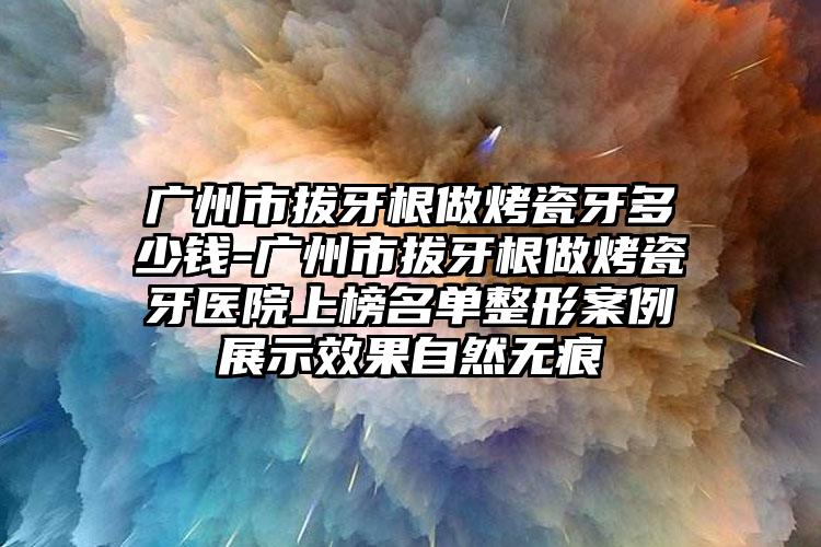 广州市拔牙根做烤瓷牙多少钱-广州市拔牙根做烤瓷牙医院上榜名单整形案例展示效果自然无痕