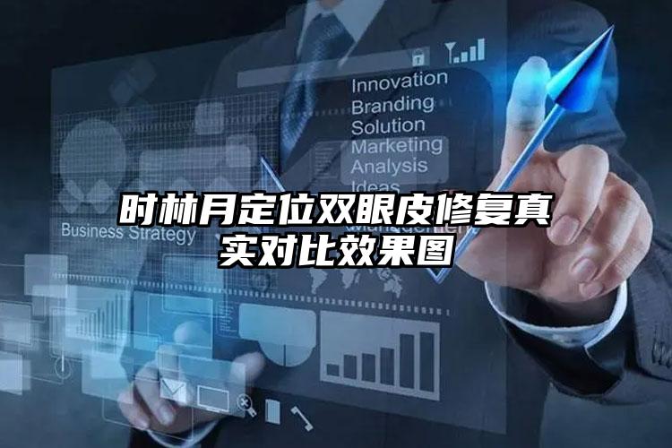时林月定位双眼皮修复真实对比效果图