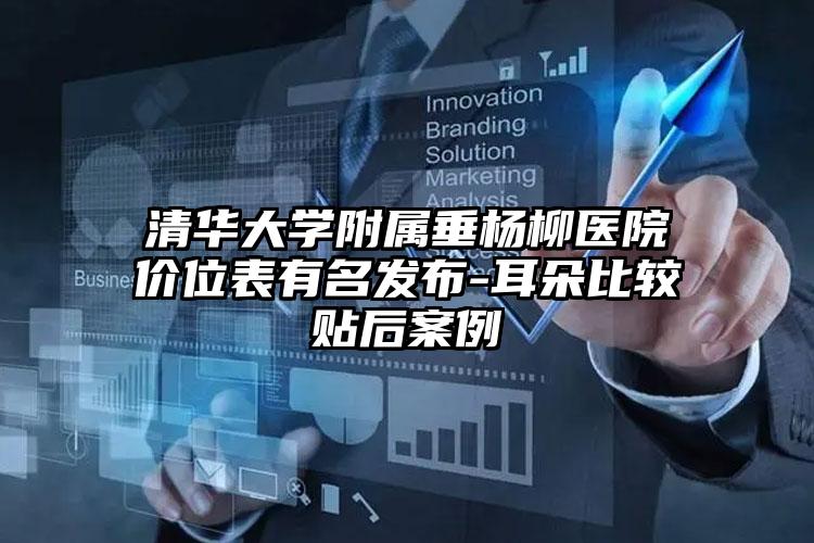 清华大学附属垂杨柳医院价位表有名发布-耳朵比较贴后案例