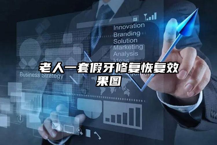 老人一套假牙修复恢复效果图
