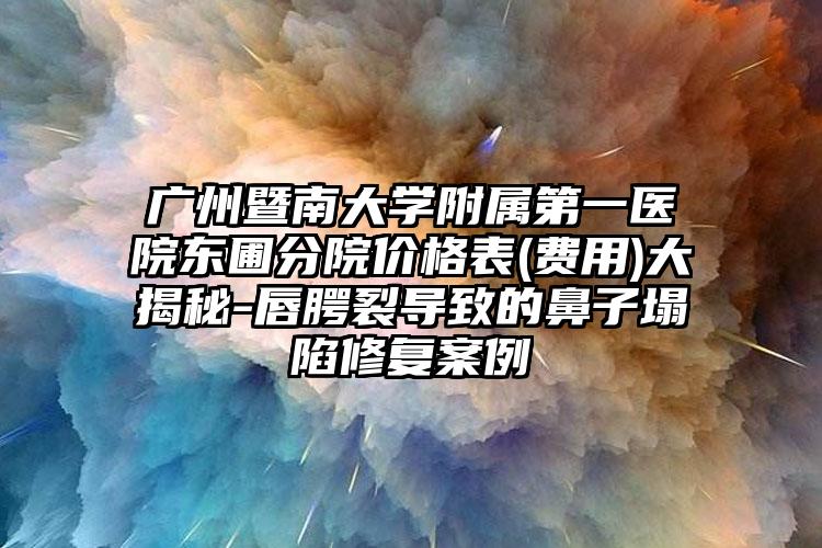 广州暨南大学附属第一医院东圃分院价格表(费用)大揭秘-唇腭裂导致的鼻子塌陷修复案例