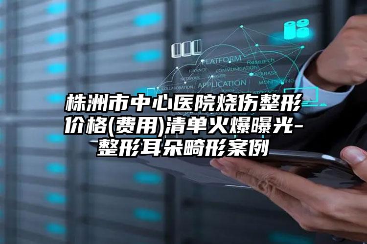 株洲市中心医院烧伤整形价格(费用)清单火爆曝光-整形耳朵畸形案例