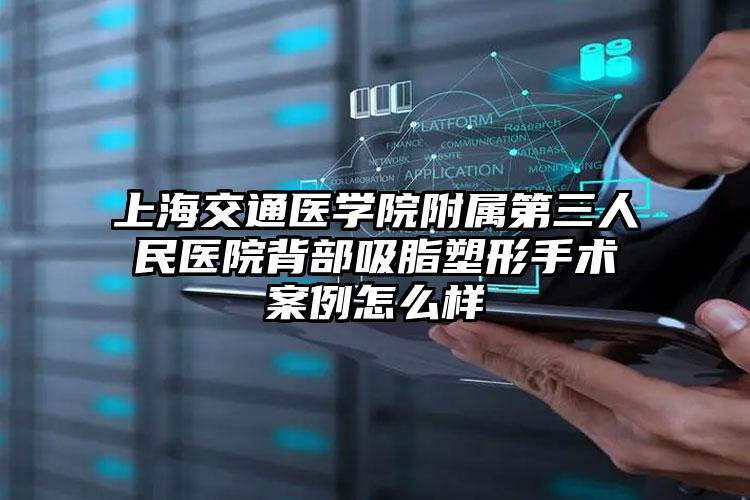 上海交通医学院附属第三人民医院背部吸脂塑形手术案例怎么样